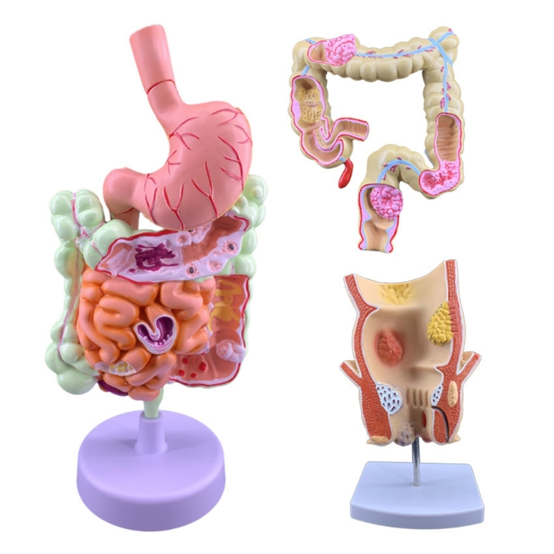 Medical Lab Observer - Q6PA 3D 病理学教育モデル、研究室観察、教室での説明およびトレーニング デモンストレーション用の PVC 解剖学ディスプレイ